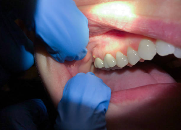 Best After-Hours Emergency Dentist in Wellston, MO